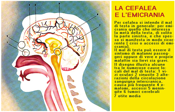 La cefalea e l'emicrania